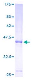 SDS-PAGE (GPLD1-5160H).jpg